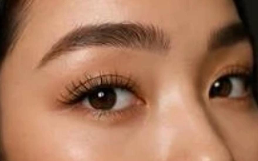 Résultat browlift — sourcils liftés et disciplinés
